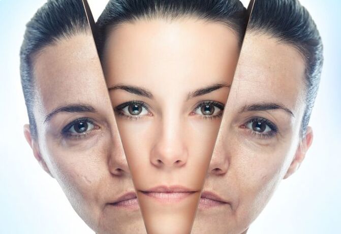 عملية إزالة بشرة الوجه من التغيرات المرتبطة بالعمر. 